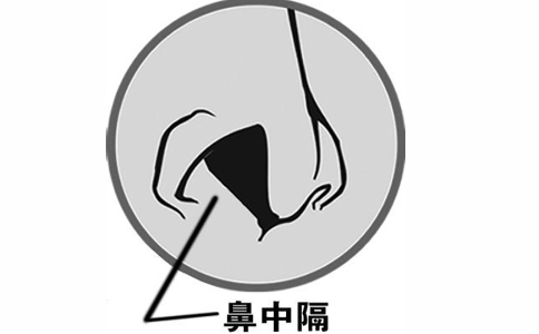 鼻中隔偏曲12