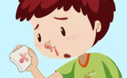 鼻出血