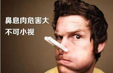 鼻息肉