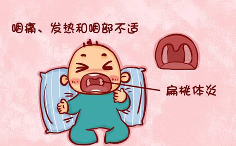 扁桃体炎