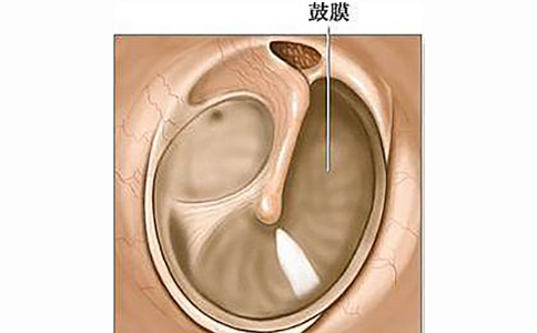 鼓膜穿孔