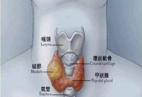 甲状腺疾病
