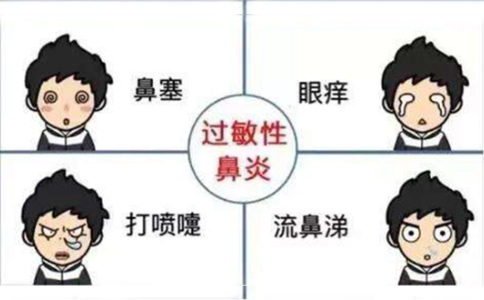 过敏性鼻炎