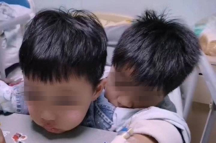 腺样体肥大
