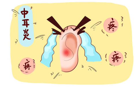 中耳炎