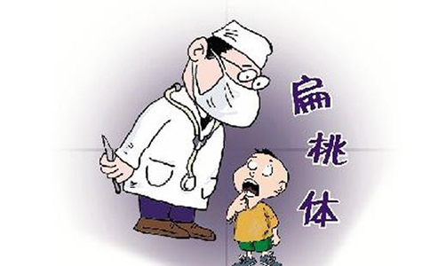 扁桃体周脓肿