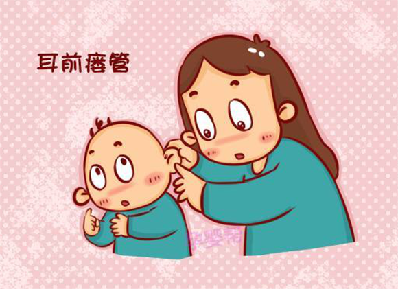 先天性耳前瘘管